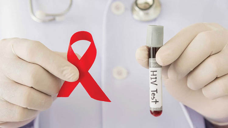 মাসে ১৮০ জন শনাক্ত: দেশে এইডস সংক্রমণ নিয়ে বাড়ছে শঙ্কা
